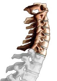 cervical_spine_illus013.jpg