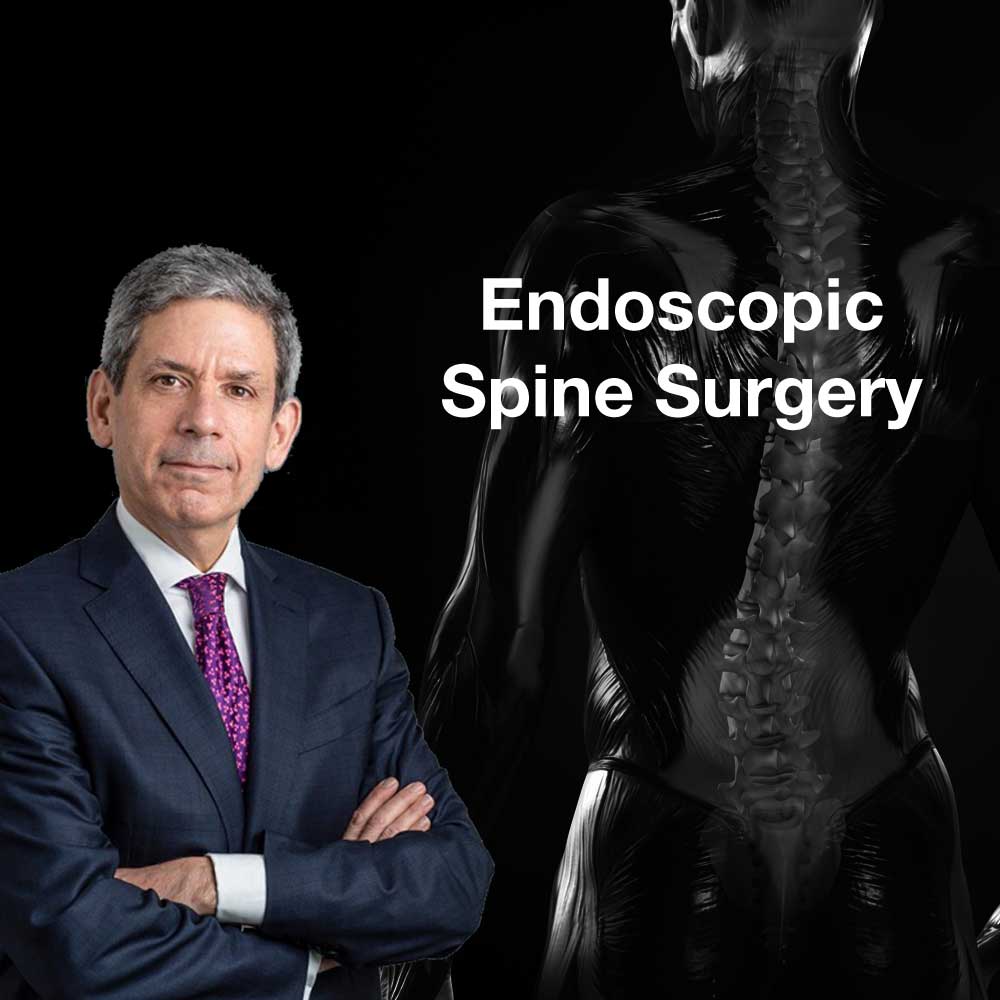 Endoscopic Spine Surgery Manhattan Top New York Spine Surgeon Endoscopic Spine Surgery Manhattan Top New York Spine Surgeon