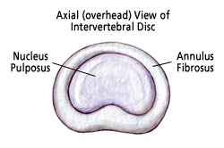 disc_superior_illus0071.gif